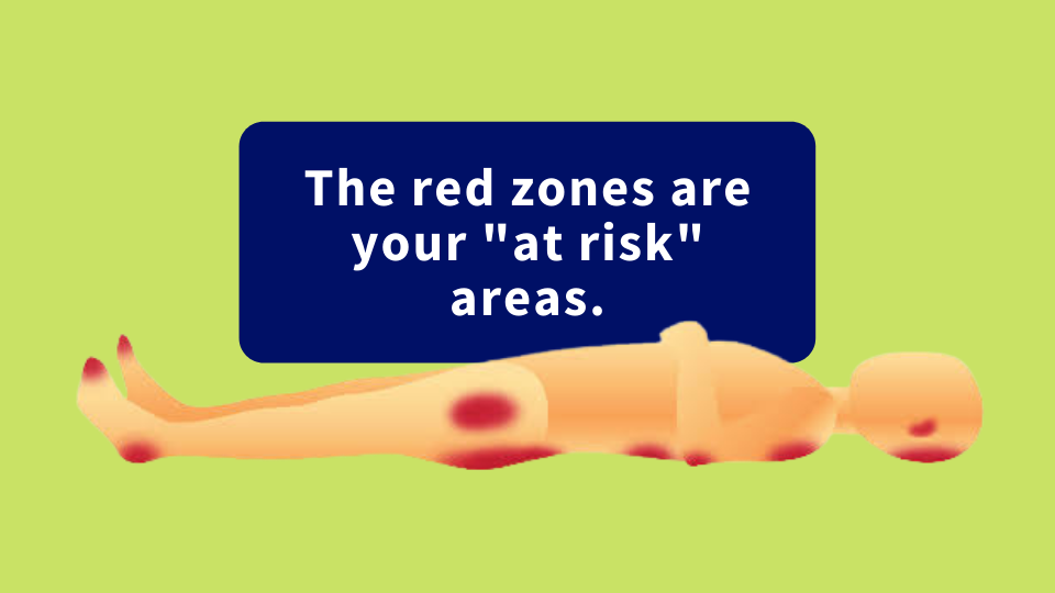 A body figure lies horizontally with red patches on the back of the head, shoulders, spine, hips, bottom, heels and toes. These are the areas at highest risk of developing pressure ulcers.